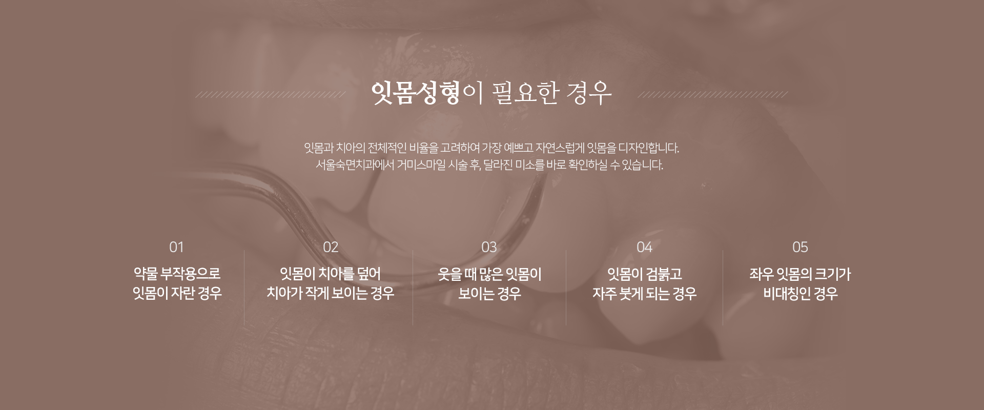 잇몸성형이-필요한-경우-잇몸과-치아의-전체적인-비율을-고려하여-예쁘고-자연스럽게-잇몸을-디자인합니다-서울숙면치과에서-거미스마일-시술-후-달라진-미소를-바로-확인하실-수-있습니다-약물-부작용으로-잇몸이-자란-경우-잇몸이-치아를-덮어-치아가-작게-보이는-경우-웃을-때-많은-잇몸이-보이는-경우-잇몸이-검붉고-자주-붓게-되는-경우-좌우-잇몸의-크기가-비대칭인-경우