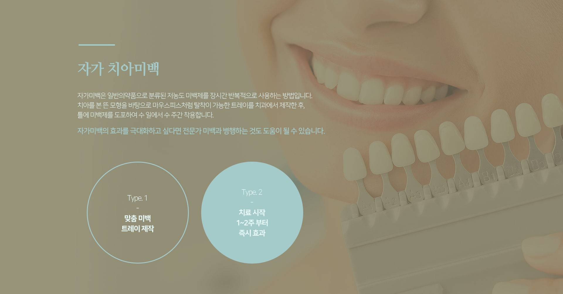 자가-치아미백-자가-미백은-일반의약품으로-분류된-저농도-미백제를-장시간-반복적으로-사용하는-방법입니다-치아를-본-뜬-모형을-바탕으로-마우스피스처럼-탈착이-가능한-트레이를-치과에서-제작한-후-틀에-미백제를-도포하여-수-일에서-수-주간-착용합니다-자가-미백과-전문가-미백을-병행할-경우-자가-치아미백-효과를-더-높일-수-있습니다-맞춤-미백-트레이-제작-치료-시작-1~2주부터-즉시-효과