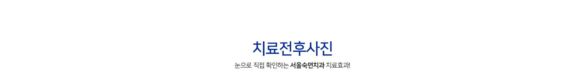 치료전후사진-눈으로-직접-확인하는-서울오치과-치료효과