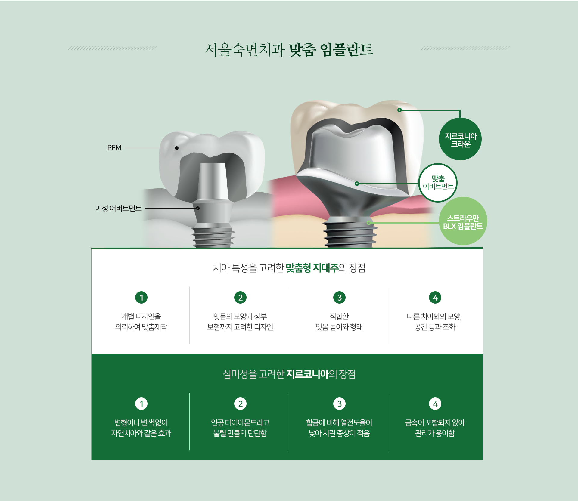 맞춤-임플란트-치아-특성을-고려한-맞춤형-지대주의-장점-첫-번째-개별-디자인을-의뢰하여-맞춤-제작-두-번째-잇몸의-모양과-상부-보철까지-고려한-디자인-세-번째-적합한-잇몸-높이와-형태-네-번째-다른-치아와의-모양-공간-등과-조화-심미성을-고려한-지르코니아의-장점-첫-번째-변형이나-변색-없이-자연치아와-같은-효과-두-번째-인공-다이아몬드라고-불릴-만큼의-단단함-세-번째-합금에-비해-열전도율이-낮아-시린-증상이-적음-네-번째-금속이-포함되지-않아-관리가-용이함
