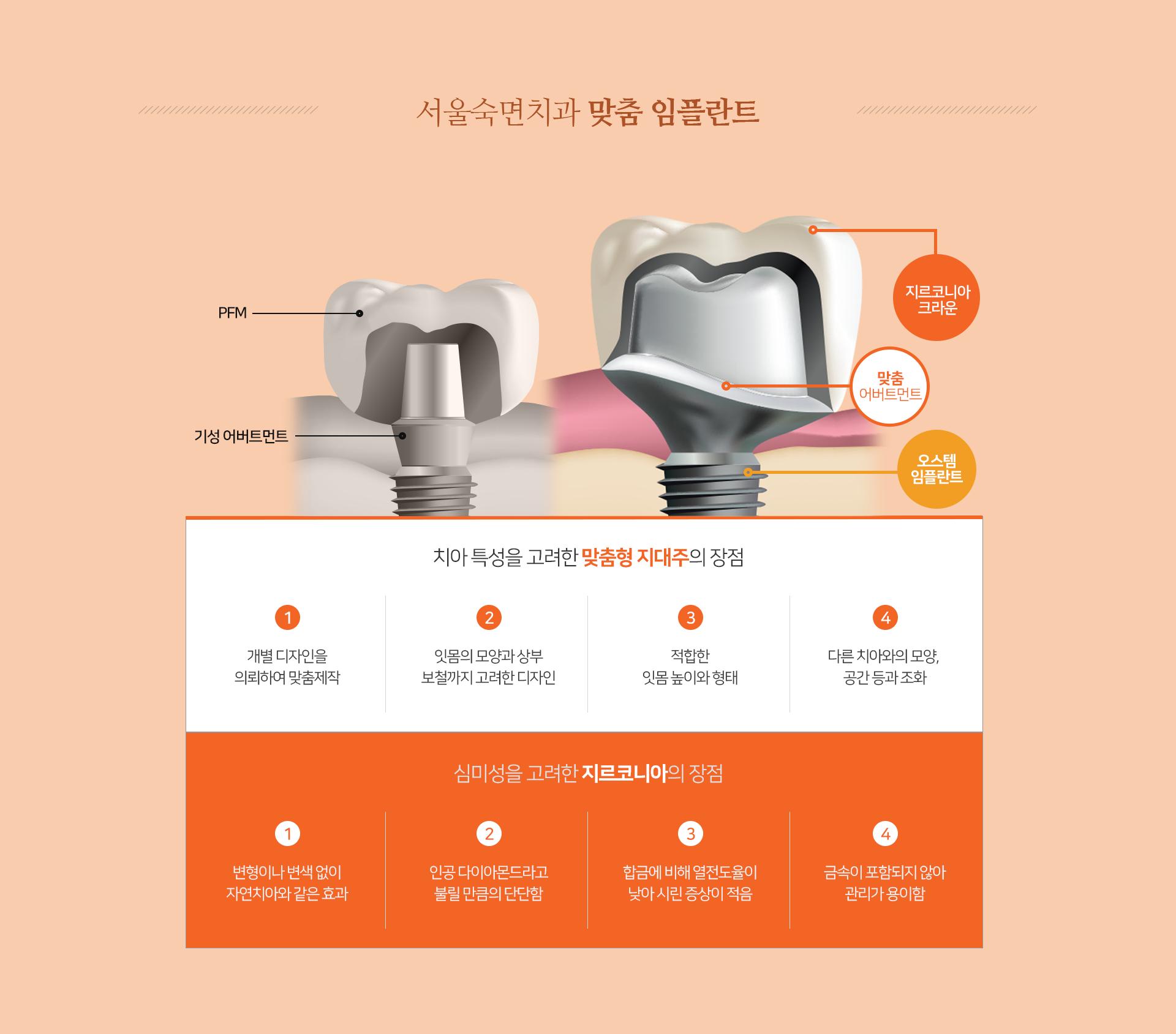 맞춤-임플란트-치아-특성을-고려한-맞춤형-지대주의-장점-첫-번째-개별-디자인을-의뢰하여-맞춤-제작-두-번째-잇몸의-모양과-상부-보철까지-고려한-디자인-세-번째-적합한-잇몸-높이와-형태-네-번째-다른-치아와의-모양-공간-등과-조화-심미성을-고려한-지르코니아의-장점-첫-번째-변형이나-변색-없이-자연치아와-같은-효과-두-번째-인공-다이아몬드라고-불릴-만큼의-단단함-세-번째-합금에-비해-열전도율이-낮아-시린-증상이-적음-네-번째-금속이-포함되지-않아-관리가-용이함