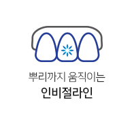 인비절라인