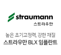 스트라우만BLX임플란트