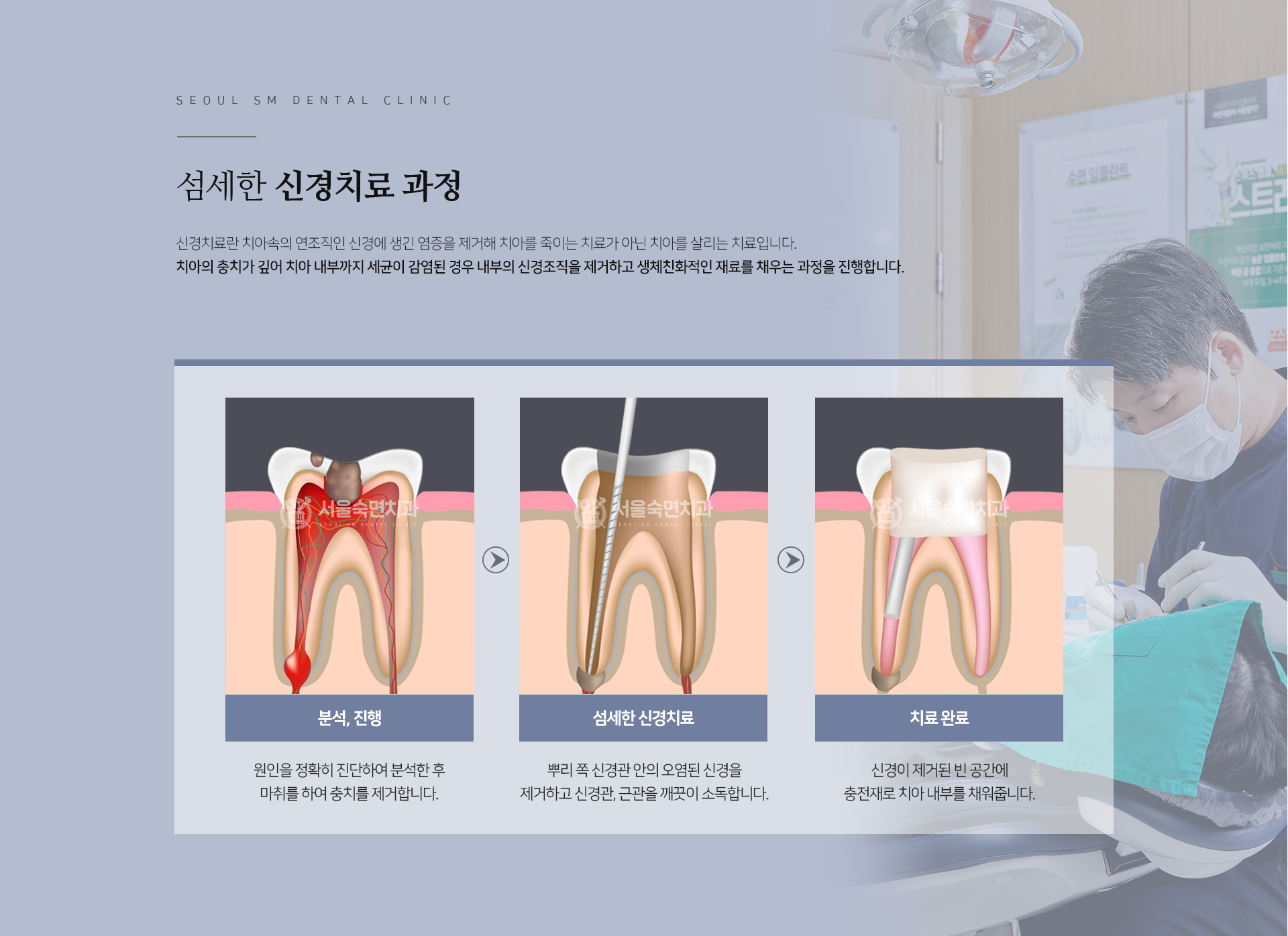 신경치료-과정-신경치료란-치아-속의-연조직인-신경에-생긴-염증을-제거해-치아를-죽이는-치료가-아닌-치아를-살리는-치료입니다-치아의-충치가-깊어-치아-내부까지-세균이-감염된-경우-내부의-신경조직을-제거하고-생체친화적인-재료를-채우는-과정을-진행합니다-1단계-분석-진행-원인을-정확히-진단하여-분석한-후-마취를-하여-충치를-제거합니다-2단계-섬세한-신경치료-뿌리-쪽-신경관-안의-오염된-신경을-제거하고-신경관-근관을-깨끗이-소독합니다-3단계-치료-완료-신경이-제거된-빈-공간에-충전재로-치아-내부를-채워줍니다