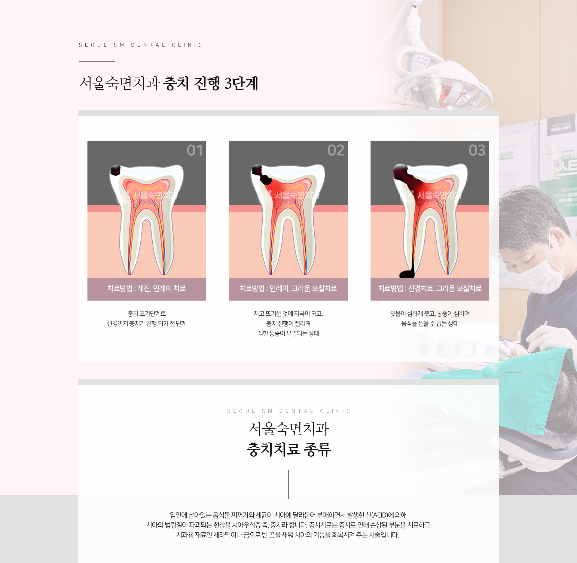 충치-진행-과정-1단계-치료방법-레진-인레이-치료-충치-초기-단계로-신경까지-충치가-진행되기-전-단계-2단계-치료방법-인레이-크라운-보철치료-차고-뜨거운-것에-자극이-되고-충치-진행이-빨라져-심한-통증이-유발되는-상태-3단계-치료방법-신경치료-크라운-보철치료-잇몸이-심하게-붓고-통증이-심하며-음식을-씹을-수-없는-상태-충치치료-종류-입안에-남아있는-음식물-찌꺼기와-세균이-치아에-달라붙어-부패하면서-발생한-산_ACID에-의해-치아의-법랑질이-파괴되는-현상을-치아우식증-즉-충치라-합니다-충치치료는-충치로-인해-손상된-부분을-치료하고-치과용-재료인-세라믹이나-금으로-빈-곳을-채워-치아의-기능을-회복시켜-주는-시술입니다