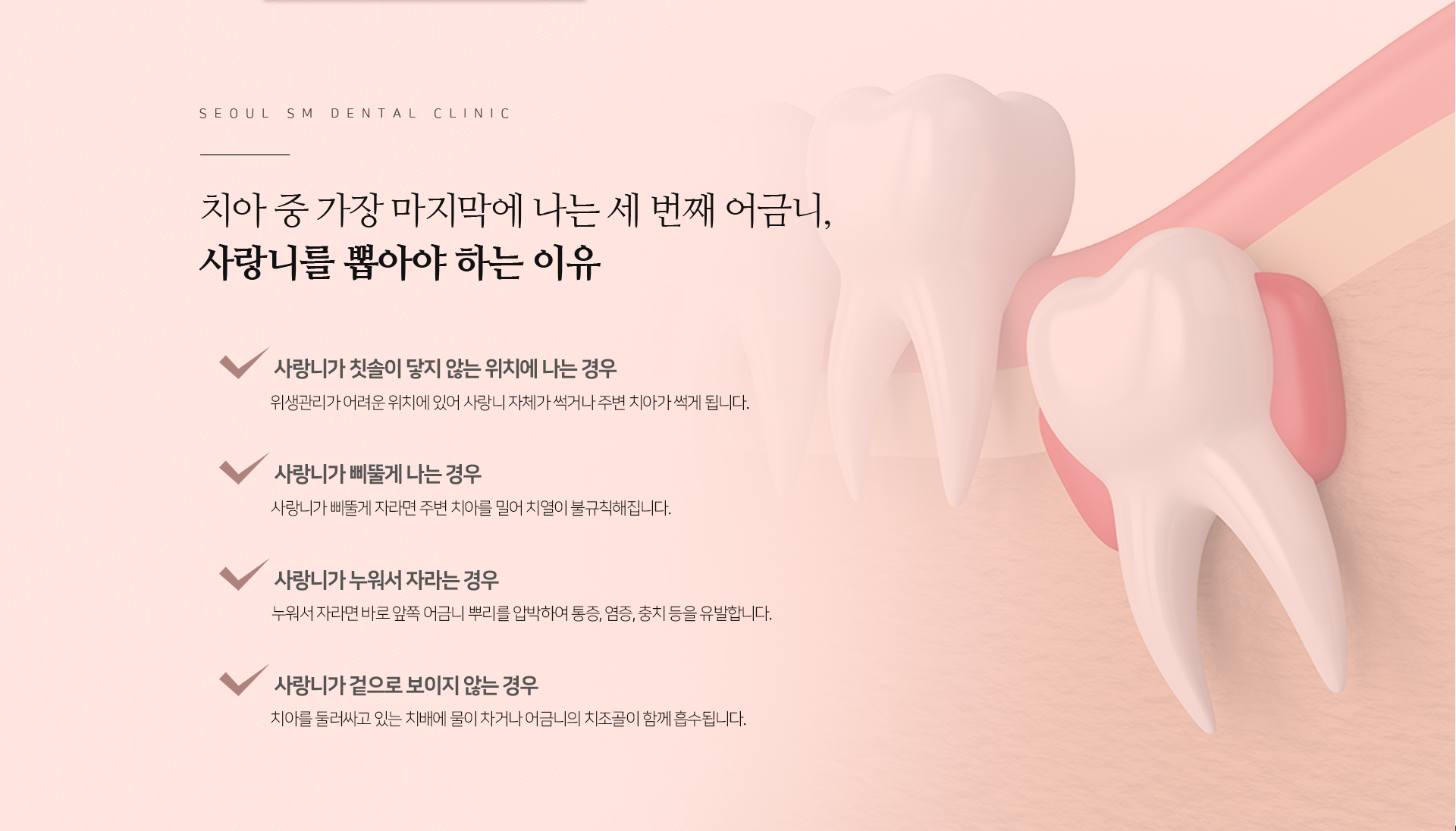 사랑니를-뽑아야-하는-이유-사랑니에-칫솔이-닿지-않는-위치에-나는-경우-위생관리가-어려운-위치에-있어-사랑니-자체가-썩거나-주변-치아가-썩게-됩니다-사랑니가-삐뚤게-나는-경우-주변-치아를-밀어-치열이-불규칙해집니다-사랑니가-누워서-자라는-경우-바로-앞쪽-어금니-뿌리를-압박하여-통증-염증-충치-등을-유발합니다-사랑니가-겉으로-보이지-않는-경우-치아를-둘러싸고-있는-치배에-물이-차거나-어금니의-치조골이-함께-흡수됩니다